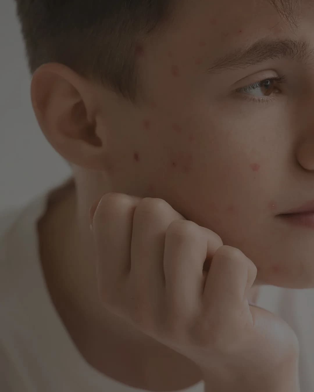 Strefa Young - świadoma pielęgnacja młodej skóry